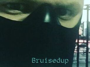 Bruisedup